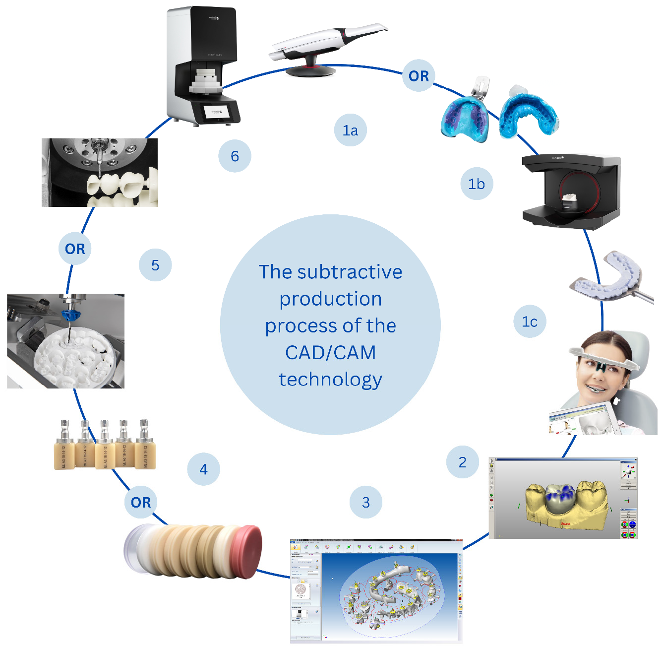Figure 1: The clinical and laboratory steps of the subtractive manufacturing procedure. 1(a) Data acquisition using intraoral scanner (Trios 4, 3Shape), 1(b) data acquisition using laboratory scanner of dental models (E Series 3Shape), impressions, and bite registration, 1(c) data acquisition using facial scanning and imaging procedures (Zebris JMA jaw registration system), 2. CAD designing (CEREC CAD system), 3. CAM manipulation of the design before the milling process (Hexagon AB), 4. Selection of suitable materials, which can be done manually or automatically in modern machines, 5. Milling of the design from the selected block or disc, 6. Finishing and sintering of the milled prostheses/restorations (inLab Profire, Dentsply Sirona).