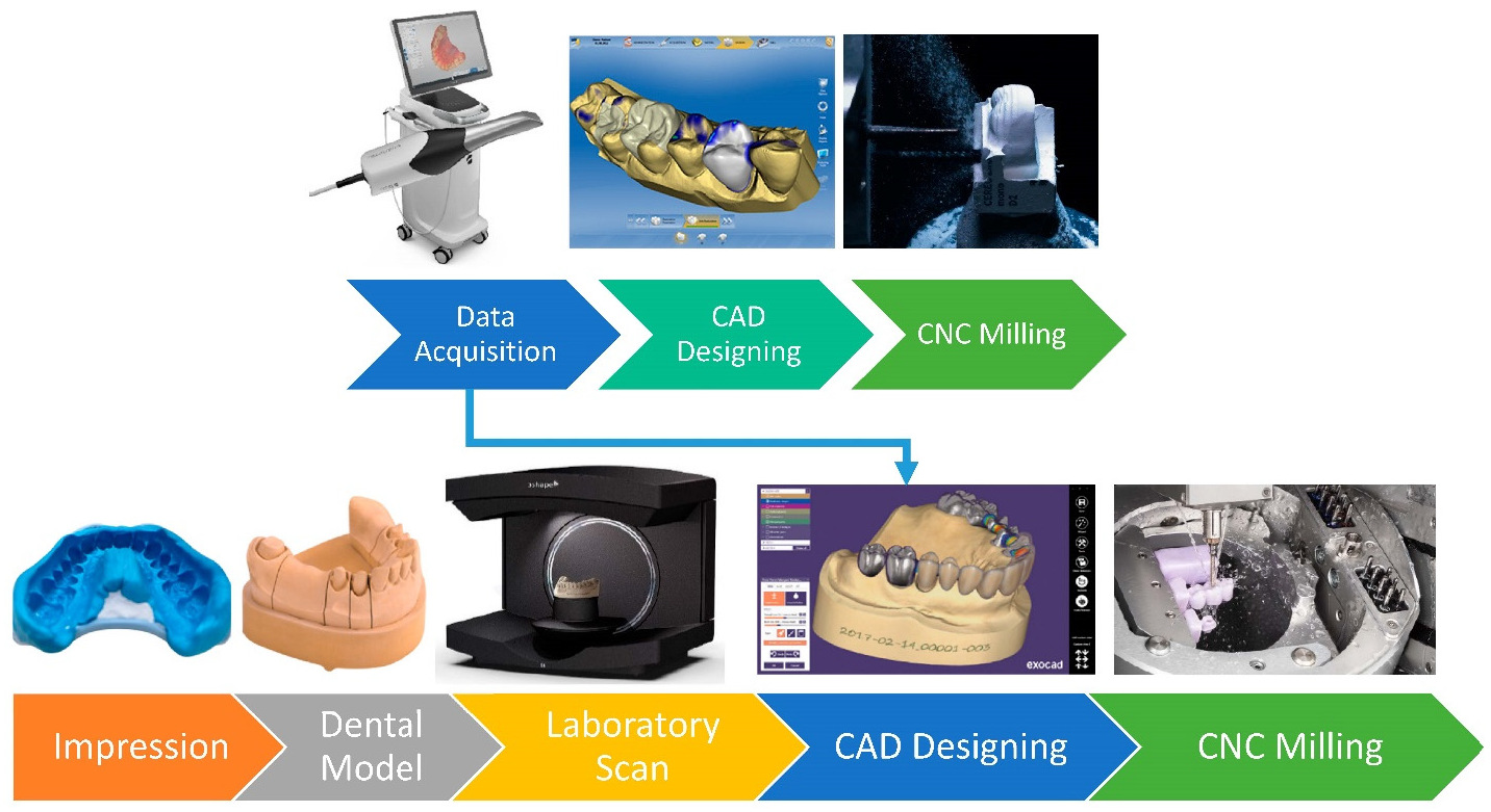 Figure 3: The steps of CAD/CAM procedures for the chairside system above and classic laboratory systems below. The arrow indicates the modern transition of laboratory systems, surpassing the conventional data acquisition process. Top left to right: CEREC chairside system, CEREC CAD design, and CEREC chairside milling. Bottom left to right: analogue impression, stone dental model (OCTA-STONE&reg;, Kulzer), InLab dental scanner (E series, 3Shape), CAD designing (Exocad), milling of single crown and 3-unit prosthesis (vhf milling machine).