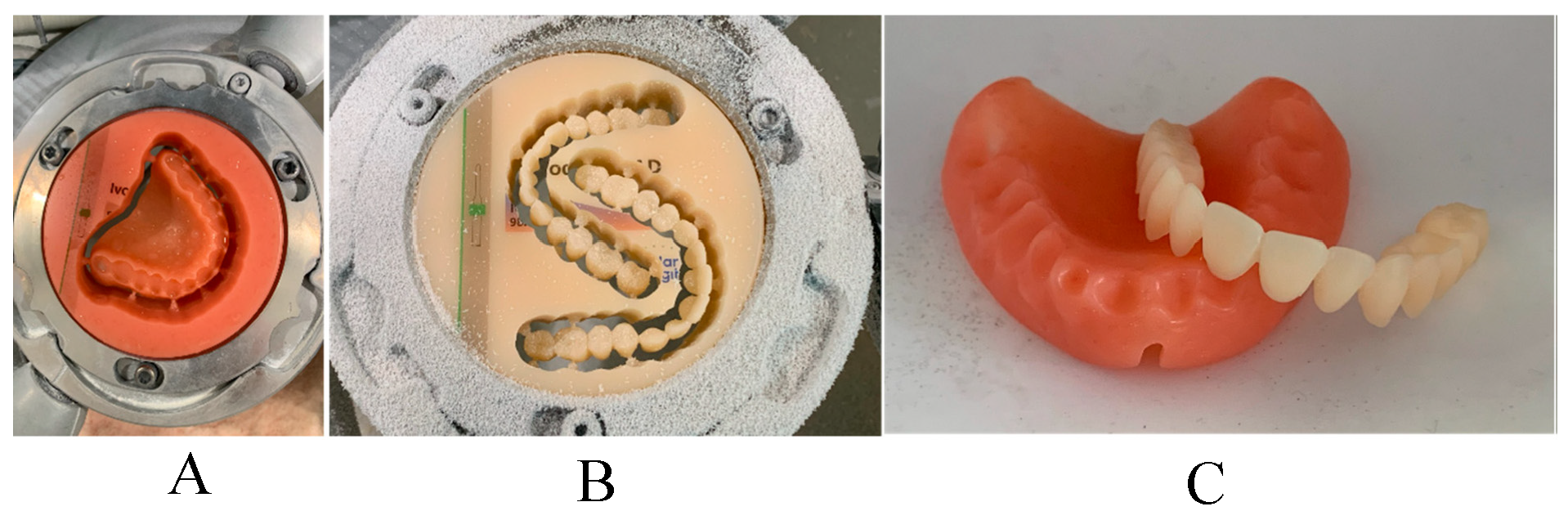 Figure 11: Directly milled complete denture, (A) milled denture base, (B) milled denture teeth, (C) the finished denture base and teeth for maxillary complete denture [190].