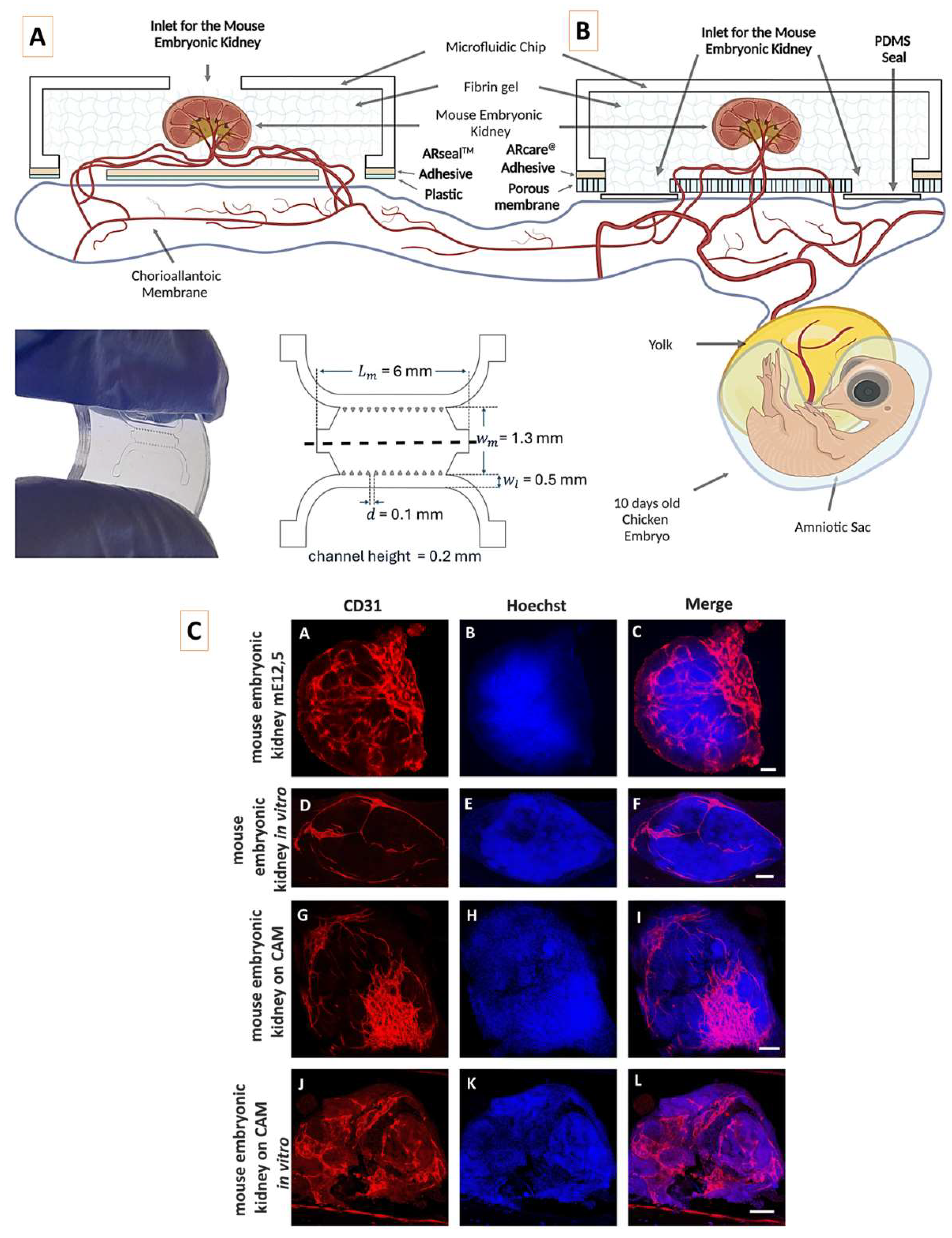 Figure 2: <p>[<strong>A</strong>,<strong>B</strong>] Schematic representation of the microfluidic chip on a CAM. Prototypes A and B are shown in lateral and top views with dimensions. The mouse embryonic kidney is schematically vascularized by capillaries originating from the chick embryo chorioallantoic membrane (CAM). Created with <a href="https://BioRender.com" target="_blank" rel="noopener noreferrer">https://BioRender.com</a>. [<strong>C</strong>] Detection of the blood vessels in mouse embryonic kidneys in different variants of the experiment. Positive control: intact mouse embryonic kidney dissected from E12,5 embryo (A&ndash;C). Negative control: mouse embryonic kidney dissected from an E12,5 embryo, cultivated 5 days in vitro (D&ndash;F). In vivo experiment. Mouse embryonic kidney E12,5 was vascularized on a chicken embryo CAM for 4&ndash;5 days (G&ndash;I). In vivo experiment after continuation in vitro. Mouse embryonic kidney E12,5 was vascularized on the chicken CAM for 4&ndash;5 days, and then cultivated for 5 days under in vitro conditions (J&ndash;L). CD31 was used as an endothelial marker (red) and Hoechst as a nuclear marker (blue). Scale bars = 50 &mu;m. (Reproduced from Oliveira et al. (2024) [<a href="#ref31">31</a>] under the provisions of Creative Commons Attribution 3.0 (Unported) License. Copyright &copy; The Royal Society of Chemistry 2024. Access date: 11 May 2025).</p>

