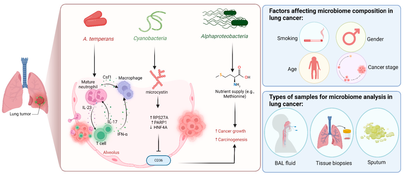 Figure 6: <p><strong>Roles of Intratumor Microbiome in Cancer Progression, Influencing Factors, and Sample Types for Microbiome Analysis.</strong> High abundance of <em>A. temperans</em> within the tumor microenvironment contributes to the promotion of lung adenocarcinoma. This microbe influences the development and maturation of neutrophils and promotes the secretion of cytokines. IL-23 and Csf1 secreted from the mature neutrophils stimulate the differentiation of monocytes and activate CD4<sup>+</sup> T cells, polarizing them to an IL-17A<sup>+</sup> phenotype, leading to a pro-inflammatory tumor microenvironment facilitating tumor growth. Through the production of the toxin, microcystin, the phylum <em>Cyanobacteria</em> increases the expression of ribosomal protein S27A (RPS27A) and procyclic acidic repetitive protein 1 (PARP1), combined with reducing the expression of HNF4A, which enhances inflammation by inhibiting CD36. <em>Alphaproteobacteria</em> are another microorganism commonly detected in lung cancers. This class of bacteria supplies crucial nutrients, such as methionine, to the cancer cells, which supports the proliferation of the latter. Several factors have been linked to the diversity of microbiome species found within the lung tumor cells. High levels of microbiomes that degrade chemicals found in cigarettes are enriched in tumor samples obtained from smoking patients. Furthermore, the gender and age of the patient, together with the stage of lung cancer, are other factors that affect the composition of the intratumor microbiome within lung cancer. To analyze the tumor-associated microbiome, different sample types have been widely used. While bronchoalveolar lavage (BAL) fluid is commonly employed, the use of biopsies from the cancer region or saliva samples has also been reported to detect lung cancer-related microbes.</p>
