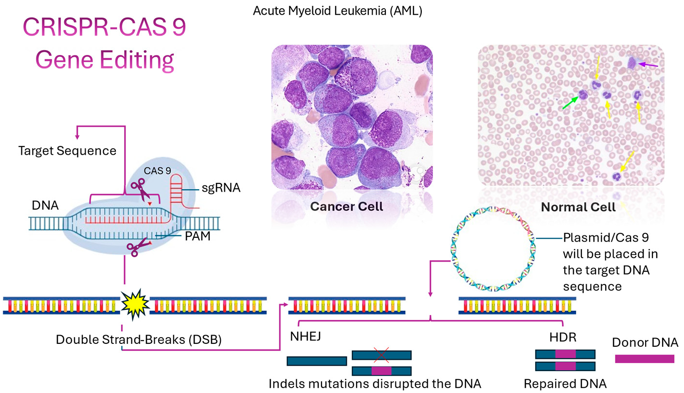 Figure 1: Mechanism of action of CRISPR/Cas9 gene therapy in AML, highlighting targeted DNA cleavage and repair pathways for precise genome editing [7,8].
