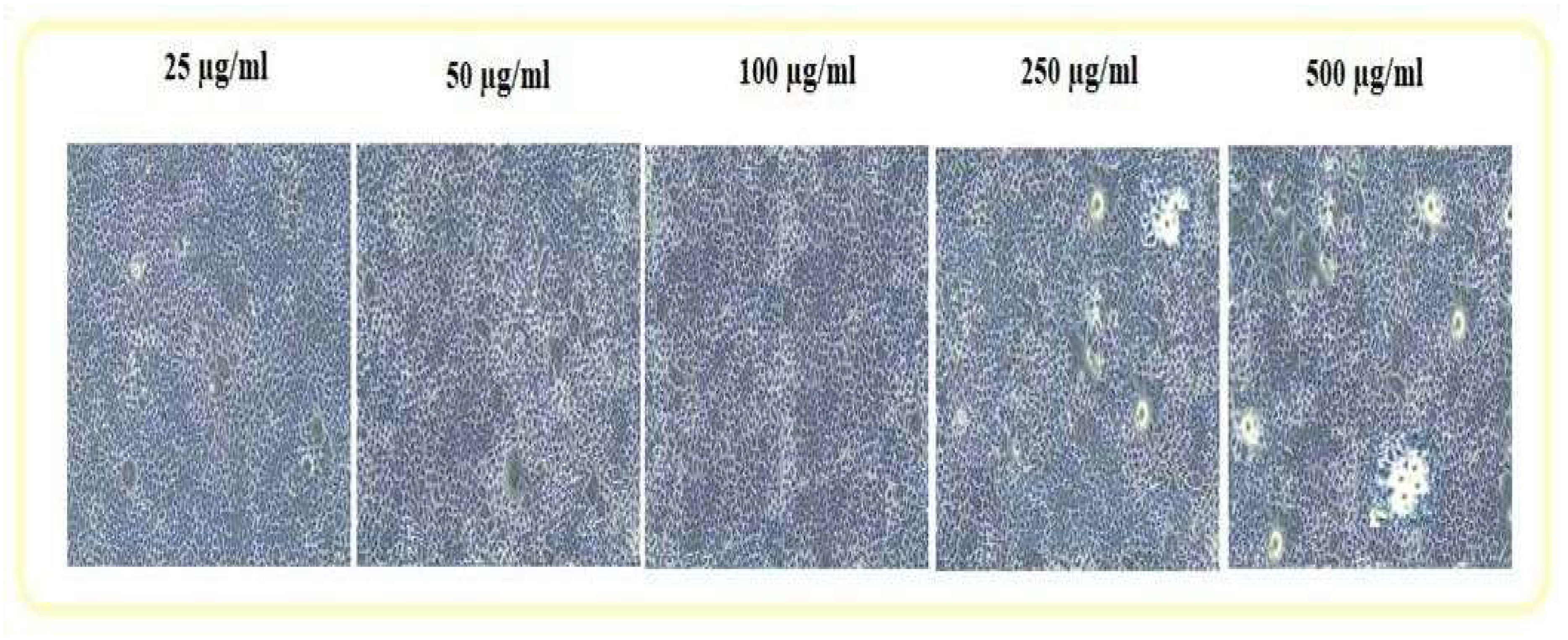 Figure 11: <p>The cytotoxicity MTT assay of CA<sub>4</sub>Z<sub>3</sub> at various concentrations.</p>