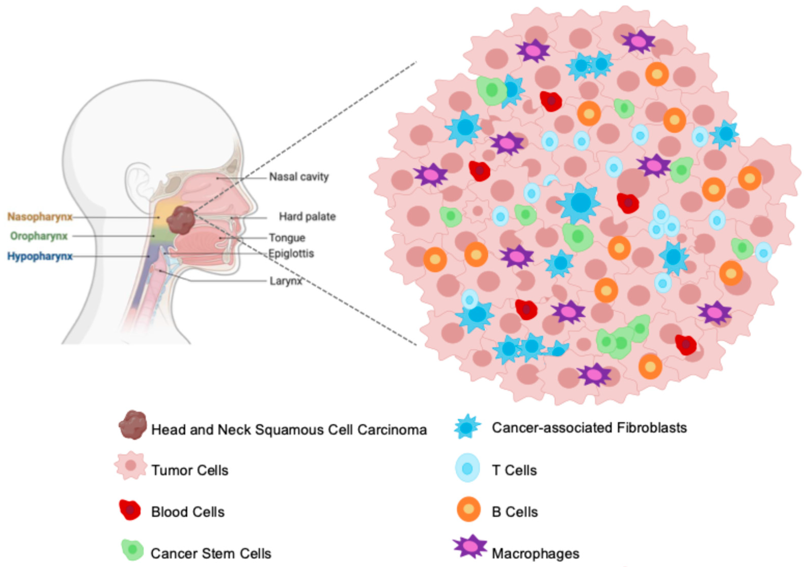 Figure 1: <p>Spatial architecture of the HNSCC TME. This schematic provides a conceptual overview of the HNSCC TME and illustrates the spatial localization and interactions of key cellular components. The left panel shows the common anatomical sites where HNSCC tumors typically arise in the human head and neck region (e.g., nasopharynx, oropharynx, hypopharynx, tongue, larynx), with the dark brown mass representing a macroscopic HNSCC tumor. The right panel provides a conceptual schematic of the HNSCC TME at a microscopic level, showcasing the diverse cellular components that interact within this complex ecosystem. It depicts Tumor Cells (pink, spiky outline) as the predominant malignant population, intermingled with other critical cell types including Cancer Stem Cells (green), Blood Cells (red), Cancer-associated Fibroblasts (light blue stars), T Cells (light blue circles), B Cells (orange circles), and Macrophages (purple stars). This schematic emphasizes cellular diversity and the mixed distribution of components within the HNSCC TME.</p>