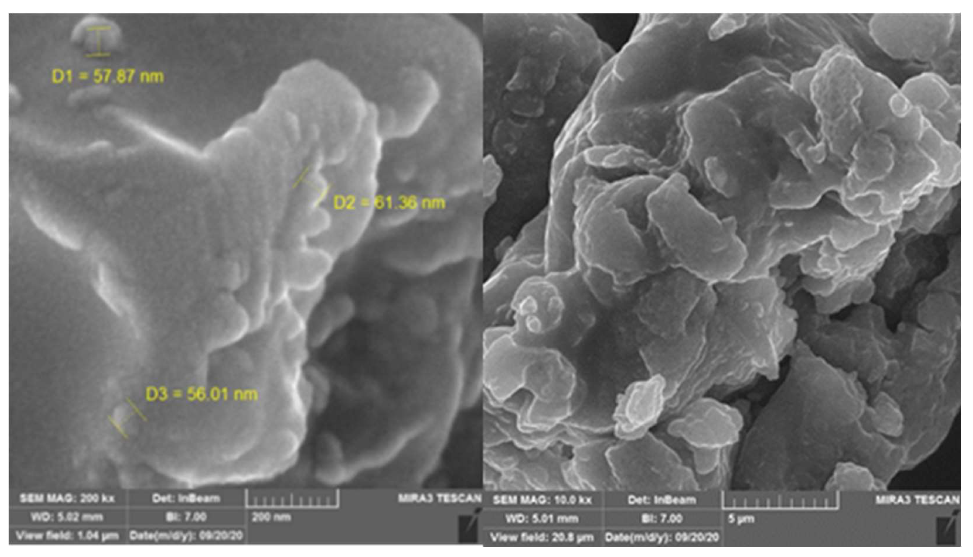 Figure 7: <p>Scanning electron microscopy image showing the morphology and dimensional properties of biosynthesized silver nanoparticles, showing a roughly spherical shape with an average diameter of approximately 58.41 nm (diameters D1 = 57.87, D2 = 61.36, and D3= 56.01 nm, shown in yellow on the micrograph).</p>